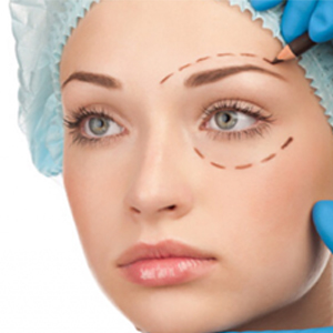 blepharoplastie