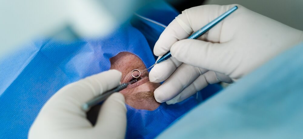 Chirurgie de la Cataracte En Tunisie