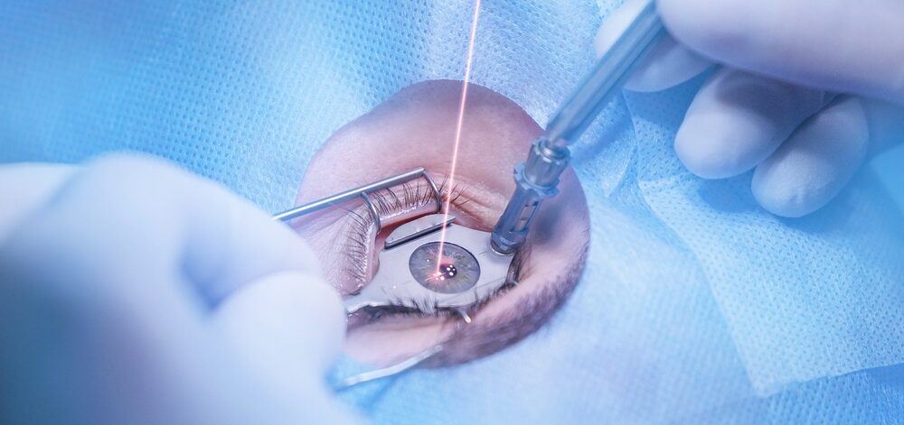 Patient undergoing LASIK surgery in Tunisia at Axess Medical, showcasing advanced laser technology and a comfortable treatment environment.