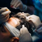 Greffe de Cheveux en Tunisie : Votre Guide Complet avec Axess Médical